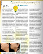 Sherwood Baxt, M.D. was featured in Cosmetic Surgery Times, October 2009, Laser Liposuction of the Neck and Jowl Line