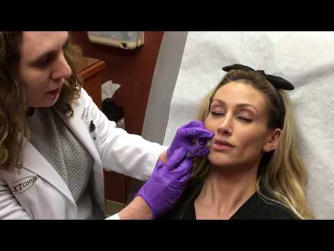 Lip Injection: Dr. Rebecca Baxt injects Juvéderm® to patient lips