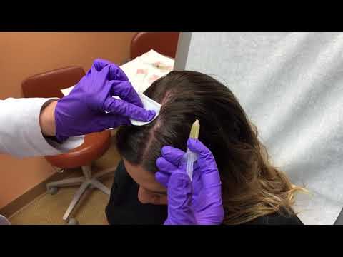 PRP injections for hair loss by Dr. Rebecca Baxt