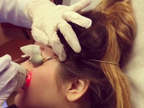 Dr. Rebecca Baxt performs Clear + Brilliant laser procedure