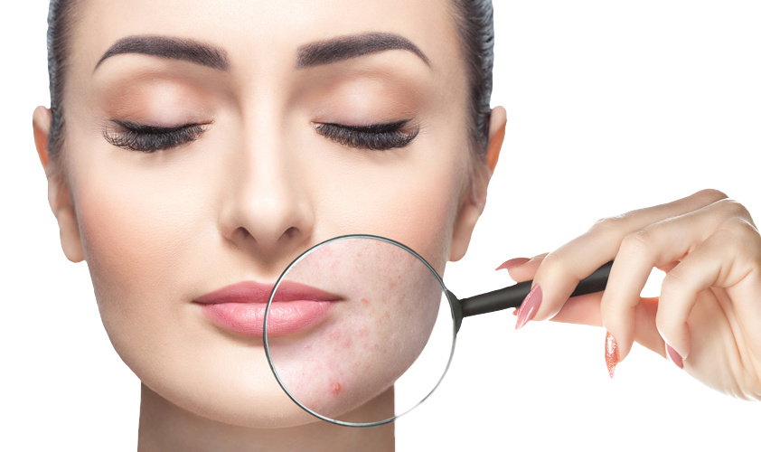 Introducing SEBACIA at BAXT CosMedical®