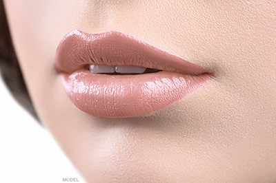 Restylane® Lips Model Photo