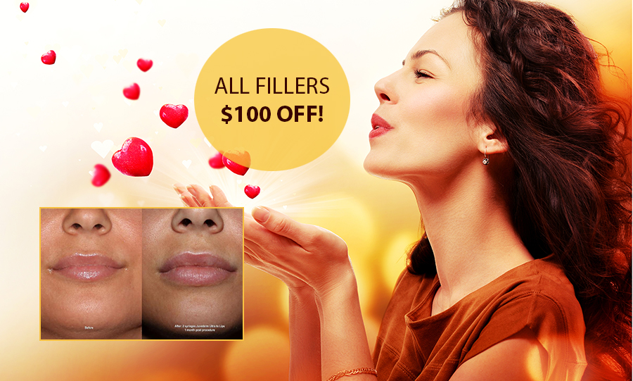 Filler Special Filler Special