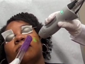 Dr. Rebecca Baxt performs Hair Removal Laser procedure