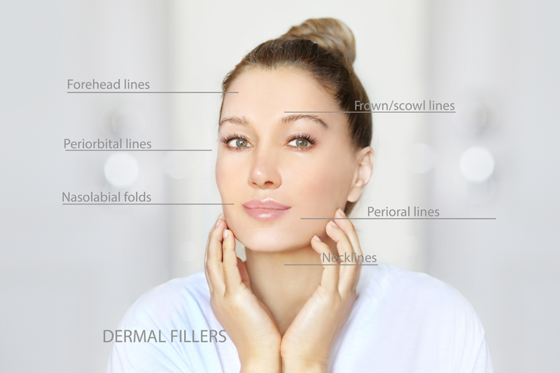 Advanced (Dermal) Fillers