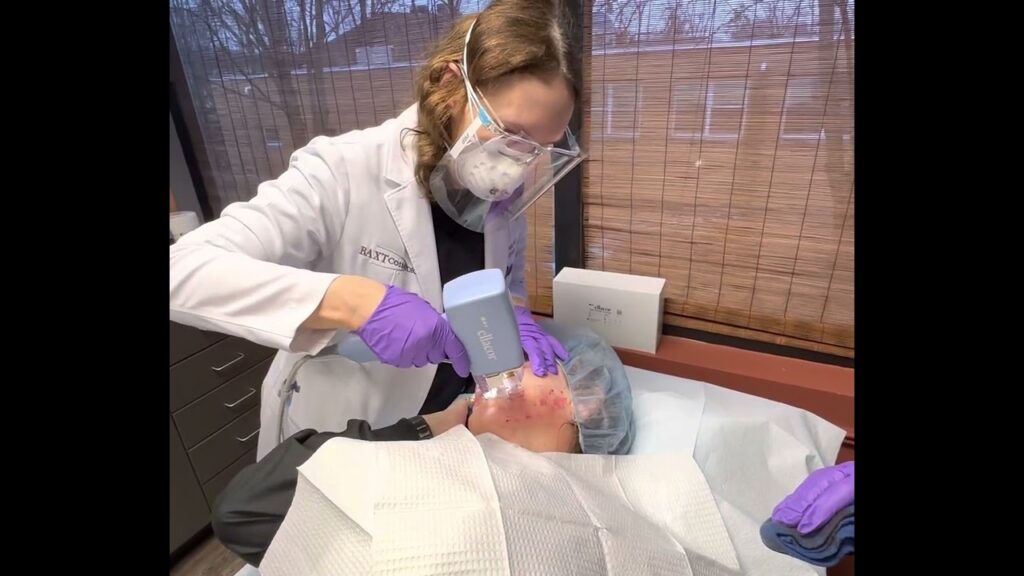 Ellacor Micro-Coring - Baxt CosMedical