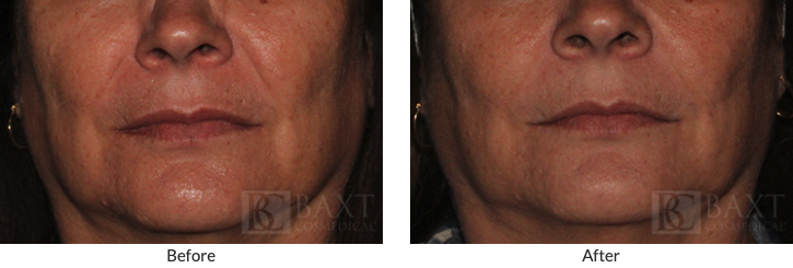 Anti-Aging Gallery B&A