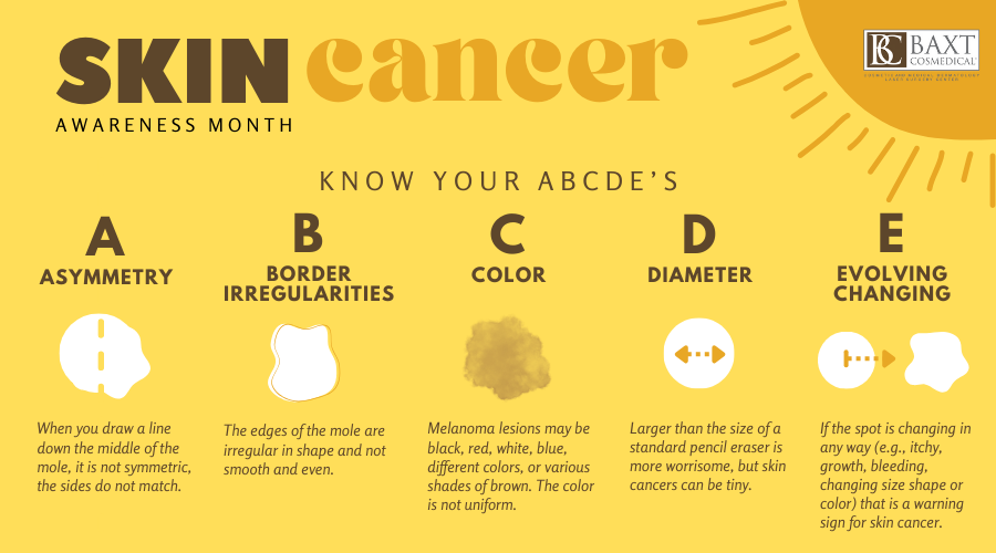 Skin Cancer Awareness Month ABCDEs