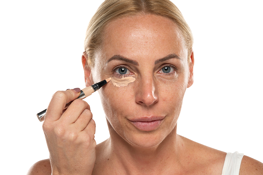 Dark Under Eye Circles...Causes and Treatments 