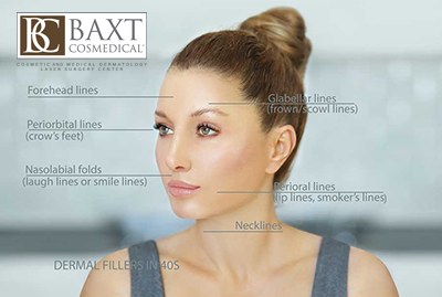 Quick Guide to Facial Fillers