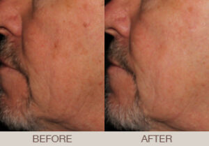 Skin Conditions Gallery