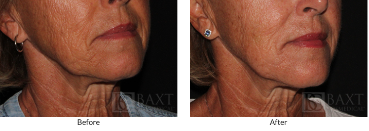 What Is The Major Cause Of Summer Skin Damage