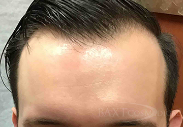 Rash Treatment After - Paramus, NJ Rash Treatment After - Paramus, NJ